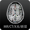 影像解剖图谱最新版v4.2.0