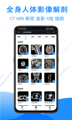 影像解剖图谱最新版截图2